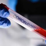 Ιταλία: 79 οι νεκροί και 2.263 τα κρούσματα από τον κορονοϊό