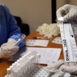 Αρνητικά τα τεστ των κινητών μονάδων του ΕΟΔΥ